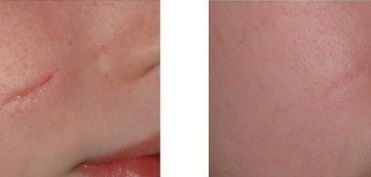 昆明知名醫(yī)生解讀三角眼與下垂眼手術(shù) 手術(shù)專業(yè)有哪些？