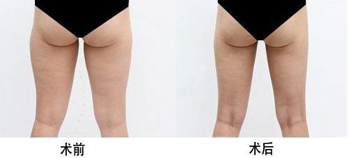 西安雙眼皮修復(fù)醫(yī)生榜單揭曉！頂級(jí)專(zhuān)家實(shí)力合集！