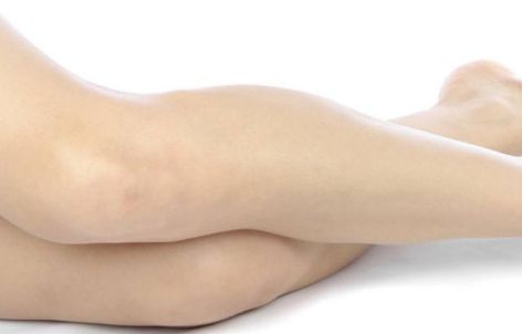 武漢華美李小丹醫(yī)生吸脂術(shù)的效果如何？案例公布供參考