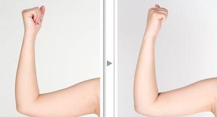 贛州市人民醫(yī)院美容整形科值得信賴嗎？2023價格表分享