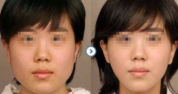 邯鄲梵星醫(yī)療美容：技術(shù)實(shí)力聚焦，項(xiàng)目擅長解讀，價(jià)格參考公開