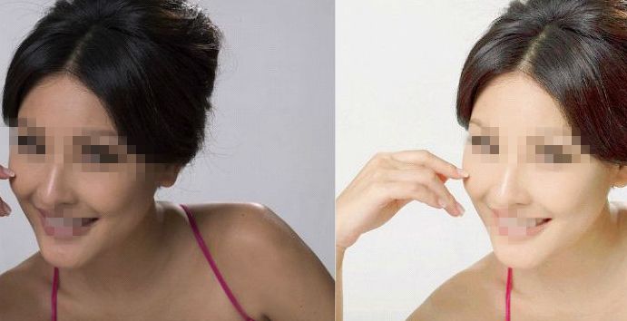 杭州哪家整形醫(yī)院排行前十，驚人綜合評價！絕不能錯過