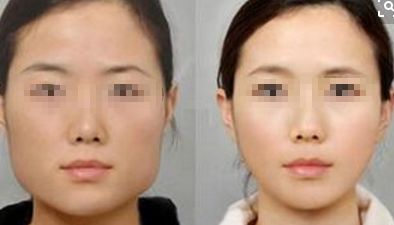 2024年鄭州市熱門整形醫(yī)院推薦，在排名前10中有哪些？