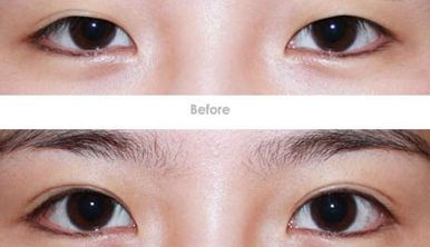 成都脂肪抽取手術(shù)的頂級(jí)醫(yī)師揭曉，五位技術(shù)高超的專家保證卓越效果