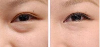 武漢愛(ài)思特整形醫(yī)院值得信賴嗎？專家團(tuán)隊(duì)丨磨骨案例丨最新報(bào)價(jià)