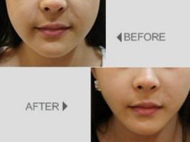 深圳整形醫(yī)院排行前三極具口碑，美麗同仁、藝星醫(yī)療、華美醫(yī)療引領(lǐng)潮流