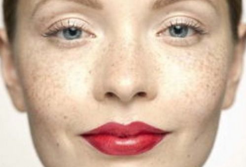 孫澤芳醫(yī)生的眼袋手術(shù)效果如何？醫(yī)生背景資料與實(shí)際手術(shù)對(duì)比圖分享