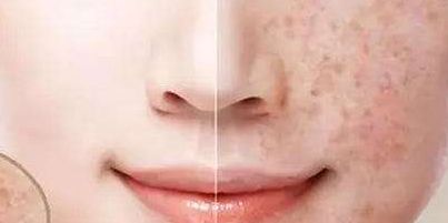 2023年大連顴骨顴弓修復(fù)醫(yī)生推薦，醫(yī)師排行公開(kāi)！附最新收費(fèi)一覽！