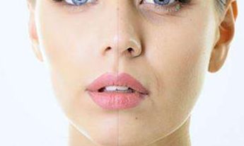 2023醫(yī)生推薦的鼻綜合重塑，讓邱文苑的鼻子煥然一新！