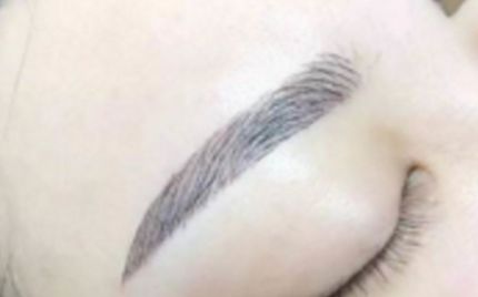 深圳拉皮手術醫(yī)生五強揭曉！千人口碑薦：排行榜、專家推薦