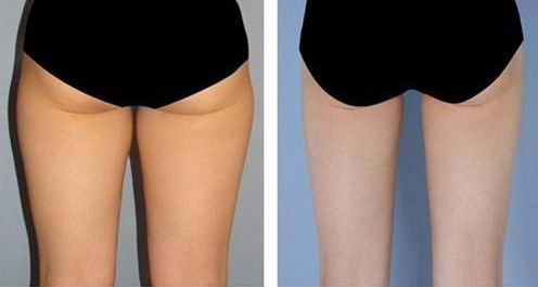 【2023】成都黃金微雕著名醫(yī)師盤點，你不容錯過！