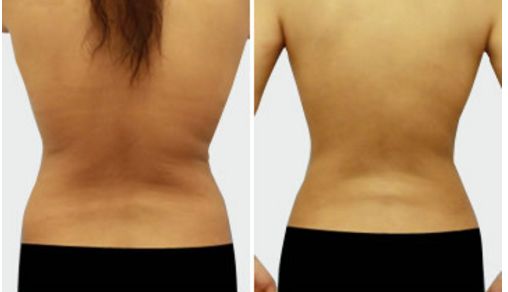 名醫(yī)孟祥宏師傅：創(chuàng)造完美鼻型的心靈藝術(shù)！