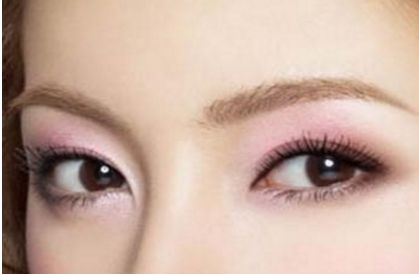 北京協(xié)和醫(yī)院白明醫(yī)生的雙眼皮手術(shù)效果如何？真實案例展示給你看