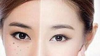 獨(dú)家揭秘！了解重慶楊武林醫(yī)生的墊下巴整形全過(guò)程