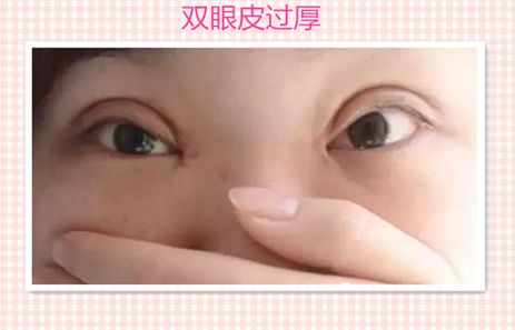 汕頭伊麗莎白醫(yī)療美容診所服務口碑分析，醫(yī)生實力深度解讀__成功案例報道