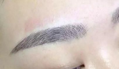 長沙何瑋醫(yī)生匠心獨具，驚艷的雙眼皮效果案例匯總