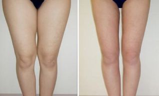 北京自體脂肪豐胸醫(yī)院獨(dú)領(lǐng)風(fēng)騷，這些機(jī)構(gòu)榜上有名