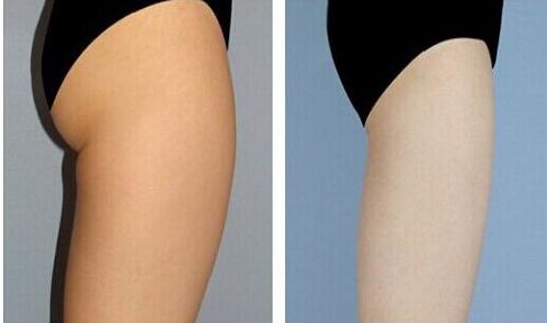 廣州著名種植牙醫(yī)生聚焦！當(dāng)?shù)責(zé)衢T牙醫(yī)簡(jiǎn)介匯總