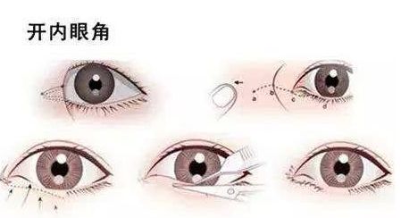 廣州畸形耳朵手術(shù)？值得收藏的醫(yī)院推薦！