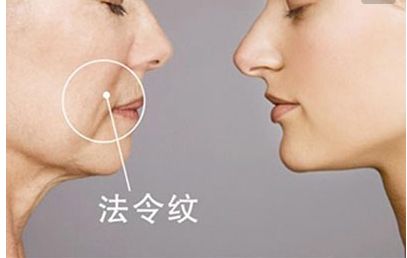 長沙田毅雙眼皮手術新穎獨特，引領2023最新潮流