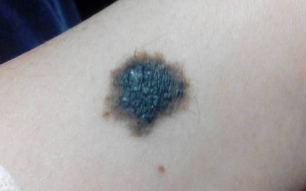 深圳青逸植發(fā)醫(yī)院技術(shù)好不好？醫(yī)生團(tuán)隊(duì)如何？能否令人信任？