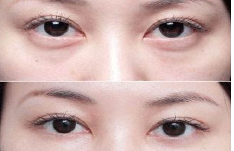 沈陽(yáng)哪個(gè)醫(yī)院的整形專(zhuān)家口碑好，醫(yī)術(shù)高超的醫(yī)生推薦