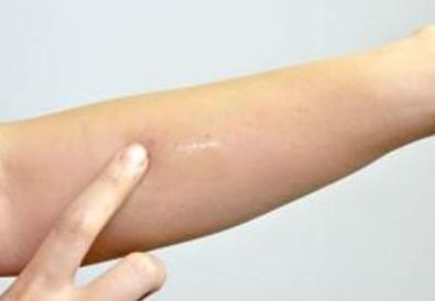 上海新星整形美容醫(yī)院——醫(yī)生團隊、價格透明一目了然!