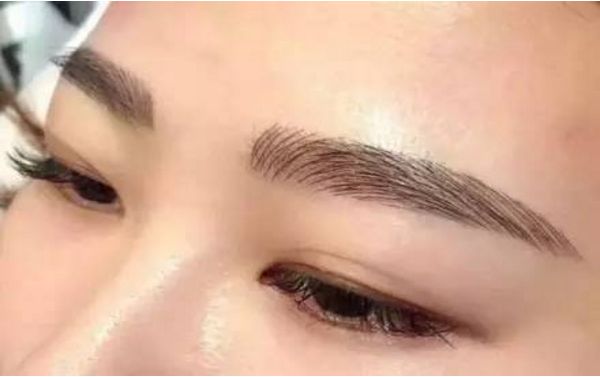 何晉龍磨骨成功，面容煥然一新！讓人難以置信的手術(shù)效果！