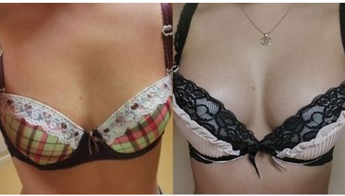 湖南地區(qū)雙眼皮手術(shù)醫(yī)生排行榜單盛裝亮相！提供熱門名醫(yī)推薦供您選擇！