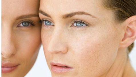 眼部修復(fù)案例比較：2023年眼睛整形術(shù)于曉波和劉輔容，哪個更理想的選擇