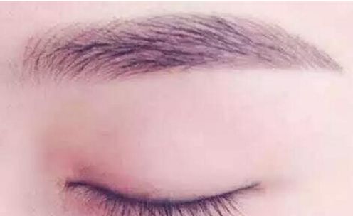 杭州頂級發(fā)際線修復(fù)醫(yī)院盤點，全方位權(quán)威排行發(fā)布，看看有沒有你心儀的醫(yī)院選擇