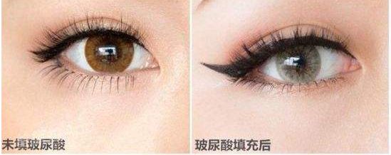 昆明市尋找雙眼皮醫(yī)生，這六位專家口碑爆棚！技術(shù)高超讓你滿意！