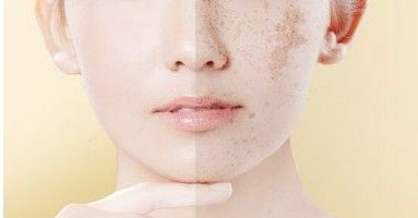 重慶新銅雀臺整形美容醫(yī)院褚健醫(yī)生的面部填充技術及真實案例分享