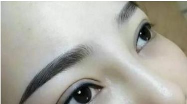 河北哪家醫(yī)院有好的雙眼皮手術(shù)推薦，整形醫(yī)院名單分享~