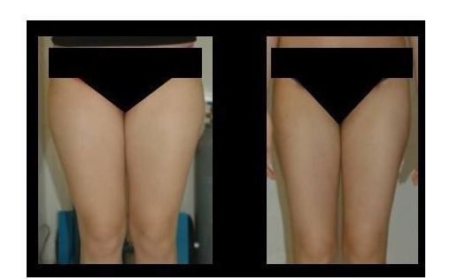 成都西區(qū)醫(yī)院整形科——專家細細解讀與價目表展示