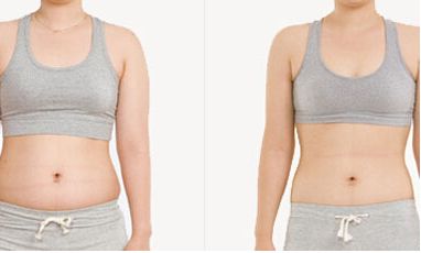 協(xié)和醫(yī)院提供熱瑪吉和超生炮手術(shù)，專家推薦！手術(shù)費(fèi)用一覽表僅參考！