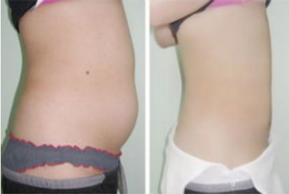 長沙哪家拉皮手術(shù)醫(yī)院靠譜？幾家實(shí)力口碑不錯，快來看看