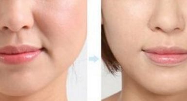 161醫(yī)院整形專家排行榜及費(fèi)用公示2023