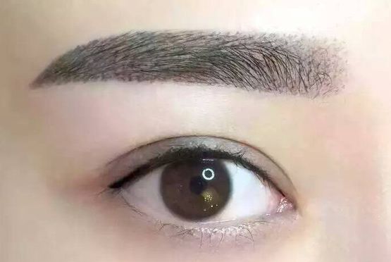 李發(fā)成整容之精彩案例分享，認識中國醫(yī)學科學院整形外科醫(yī)院