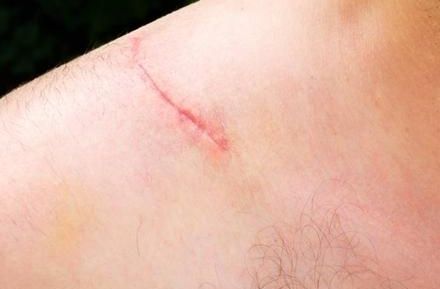 全國(guó)隆鼻專家排行榜發(fā)布！實(shí)力專家揭秘，經(jīng)驗(yàn)豐富！