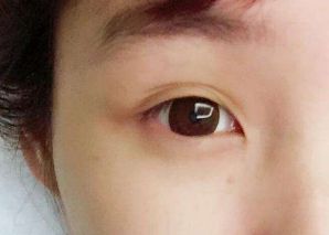 2023寧波隆鼻醫(yī)生排行榜：張廣巍、任森洋、肖慶華五位備受矚目的醫(yī)師解析及收費信息！