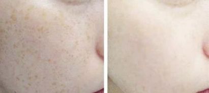 2023昆明下頜角整形臉部護(hù)理達(dá)人該怎么樣選擇？陳曦、錢(qián)靜、楊保祥等讓您信賴(lài)！