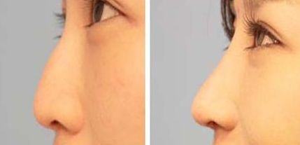 哈爾濱頂級(jí)美容整形醫(yī)院前七評(píng)選結(jié)果揭曉，驚喜連連！公立醫(yī)院也進(jìn)榜，讓你驚嘆不已！