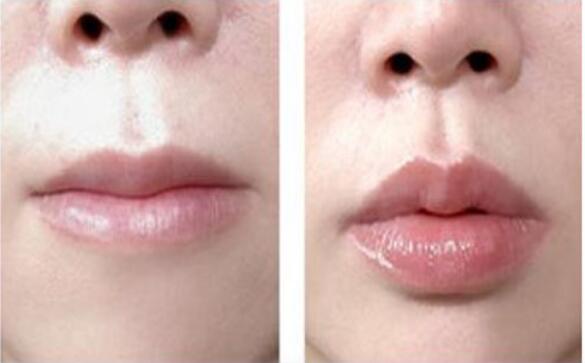 北京柏麗整形醫(yī)院的整形效果如何？有哪些專家醫(yī)生可以選擇？