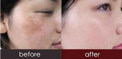 西安最佳雙眼皮手術(shù)醫(yī)院推薦，網(wǎng)友口碑評價！