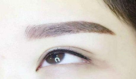 咨詢陳曉勇醫(yī)生雙眼皮手術(shù)效果如何？親身經(jīng)歷分享一覽