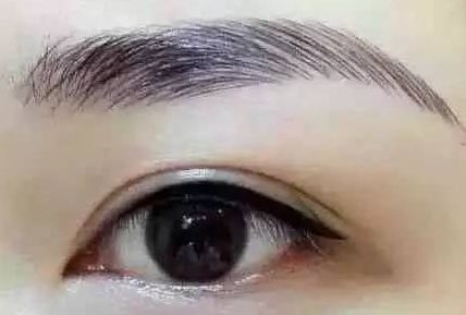 各路醫(yī)生實(shí)力大比拼！同帥與楊亞益，誰在雙眼皮手術(shù)上更出彩？