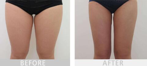 2023年德化縣醫(yī)院整形外科價目表是否已經(jīng)公布？鄭向陽的口碑和經(jīng)驗如何進行深度評點？案例欣賞？