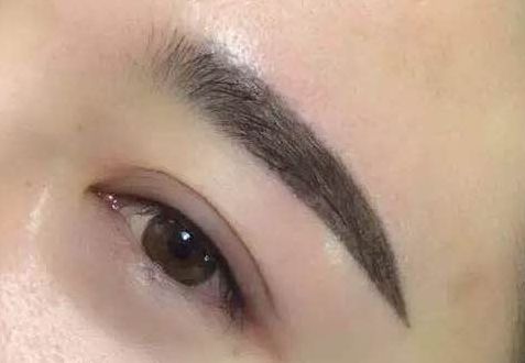 上海薇琳整形醫(yī)院：近期面部吸脂驚艷案例揭秘！