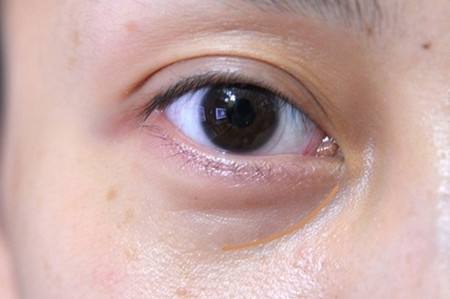 深圳北大醫(yī)院美容皮膚科的詳細資料是什么？如何了解更多有關深圳北大醫(yī)院美容皮膚科的信息？